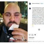 Brutal agresión a Lázaro Mireles ayer noche en Madrid.